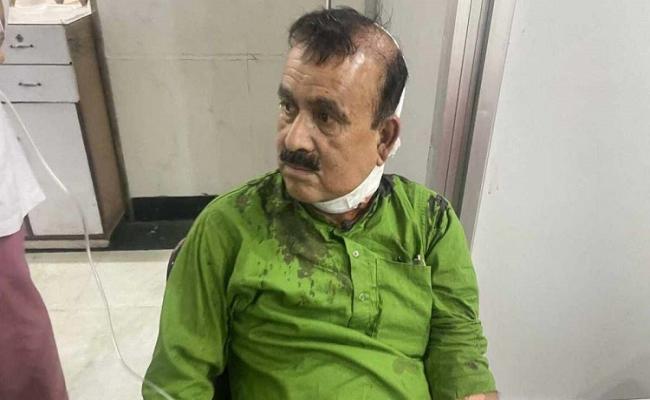 नेपाल के पूर्व मंत्री पर खुकुरी से जानलेवा हमला, ट्रॉमा सेंटर में भर्ती