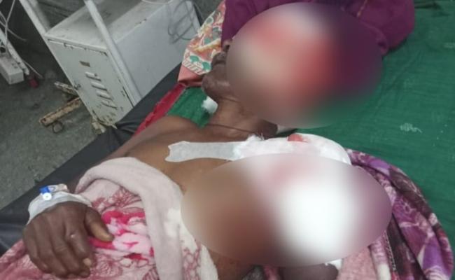कोरबा: ग्रामीण पर भालू ने किया प्राणघातक हमला, ग्रामीण गंभीर हालत में सिम्स अस्पताल रेफर