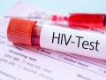 लखनऊ कारागार में 36 एचआईवी संक्रमित बंदियों की काउंसिलिंग शुरू
